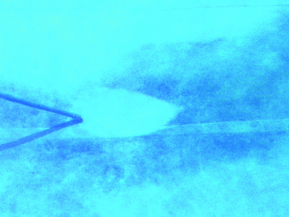 traitement des eaux